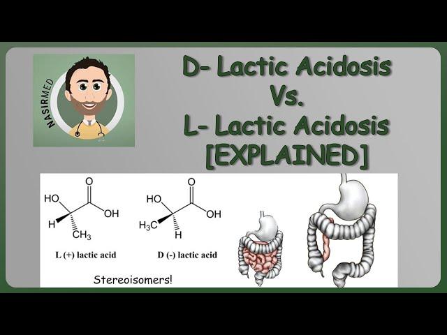 D Lactic Acidosis vs. L Lactic Acidosis - Explained (NYK Series - Episode #2)