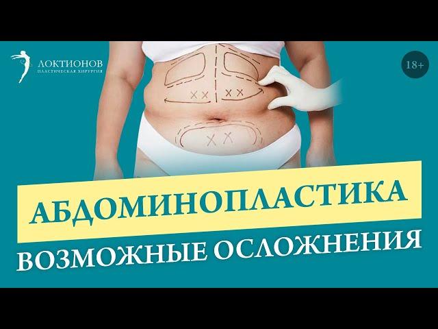 Осложнения после пластической операции // 18+