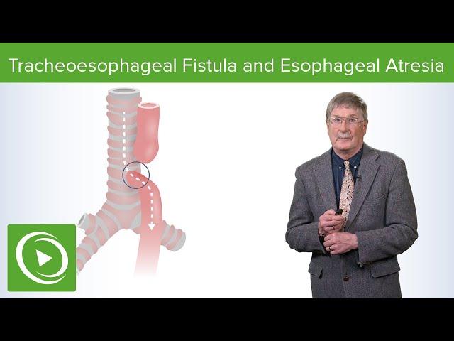 Tracheoesophageal Fistula and Esophageal Atresia | Lecturio Medical