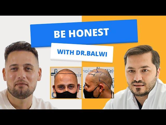 HAIR Transplant BEFORE AFTER I with Dr Balwi