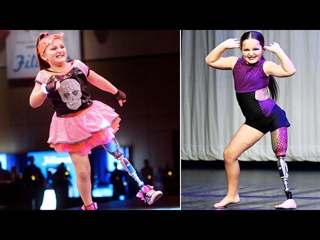 8-Year-Old Dances With Prosthetic Leg