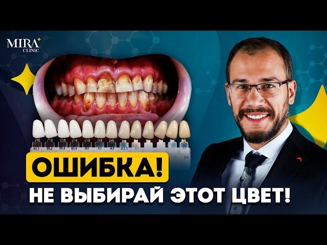 Форма и Цвет Виниров! Как сделать, чтобы зубы выглядели ЕСТЕСТВЕННО?