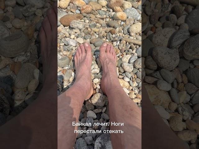 Байкал лечит отёки ног.