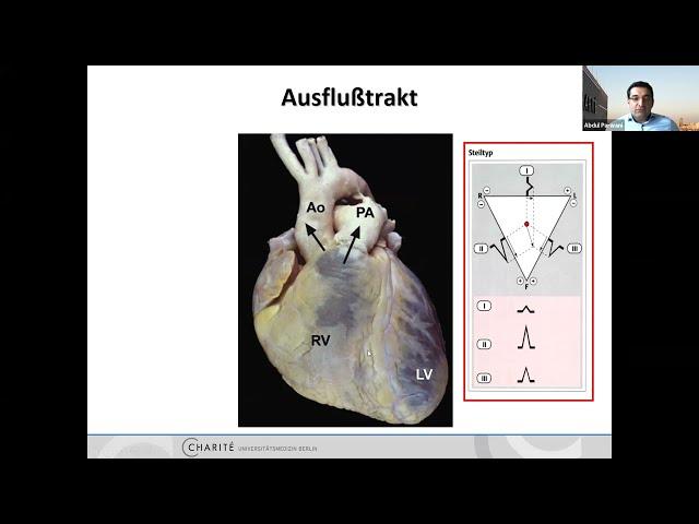 EKG - From Beginner To Boss | Teil 5 | Fast & Furious 3 - mit Dr. Sebastian Feickert