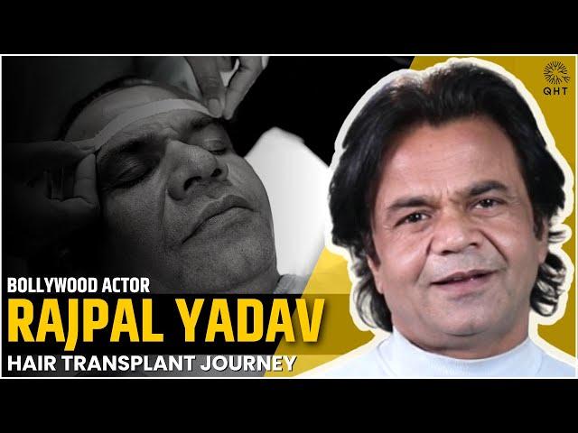 Rajpal Yadav | Bollywood Actor Hair Transplant Journey at QHT Regrow Clinic Haridwar