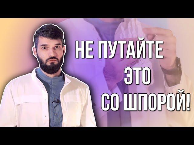 10 БОЛЕЗНЕЙ, ПОХОЖИХ НА ПЯТОЧНУЮ ШПОРУ @arturtadj