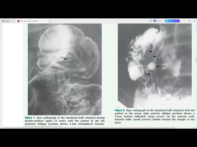 GIT IMAGING THE TEACHING FILES SERIES