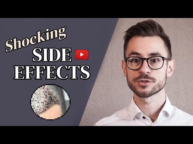 Hair Transplant Side Effects [5 MOST COMMON]