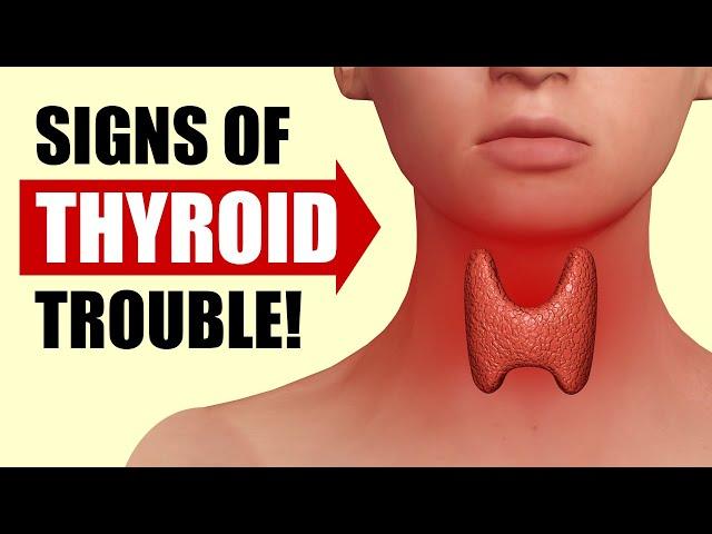 14 Signs Your Thyroid Is In Trouble
