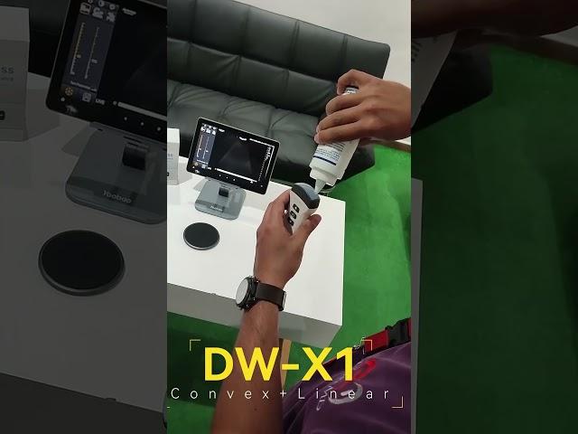 Wireless handheld Ultrasound probe DW-X1----Convex probe  Linear probe---Customer's feedback