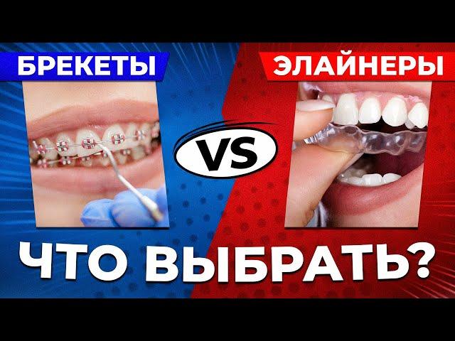 Брекеты или элайнеры - что выбрать?