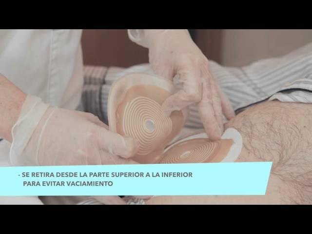 Tutoriales para cuidadores -  Cuidados de Ostomia