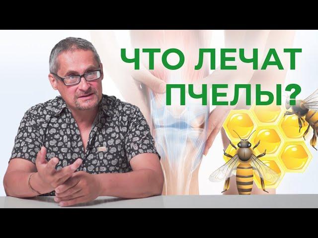 ЧТО ЛЕЧАТ ПЧЕЛЫ? Апитерапия, пчелоужаливание.