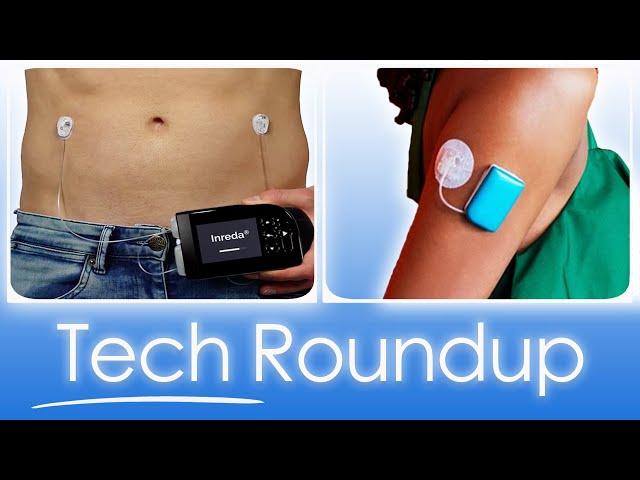 Diabetes Tech Roundup - EASD 2024