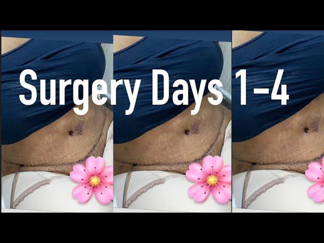 SURGERY VLOG PART 3  (Surgery days 1-4)