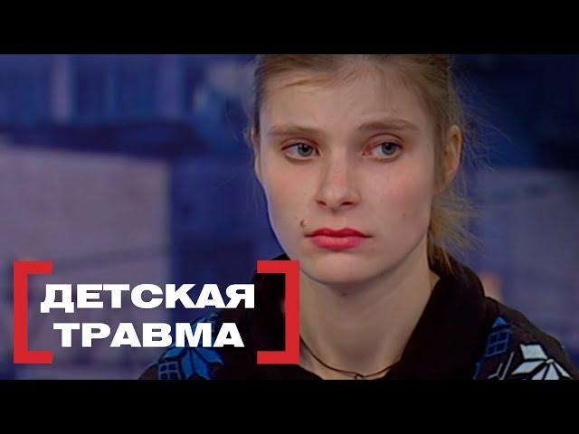 Детская травма. Касается каждого, эфир от 26.01.2018