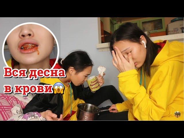 ПРАНК НАД СЕСТРОЙ: ДЕСНА ИСТЕКАЕТ КРОВЬЮ! // Kagiris Twins