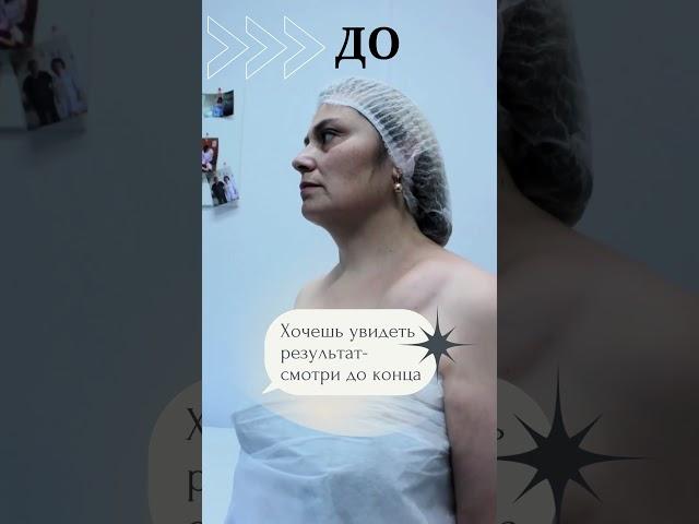 Миофасциальный массаж лица. Скульптурный массаж лица.