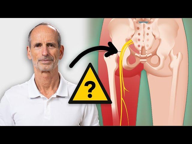 SCIATICA Pain: 3 important exercises for EVERY DAY