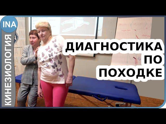 Диагностика болезни по походке. Миофасциальные цепи. Прикладная кинезиология Васильева Л.Ф.