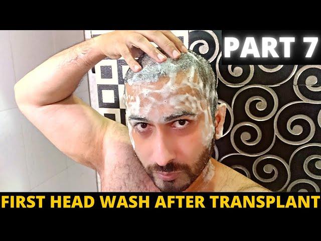 First Head wash After Hair Transplant | Born Creator