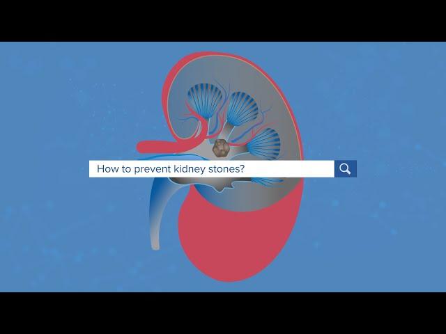 How To Prevent Kidney Stones?