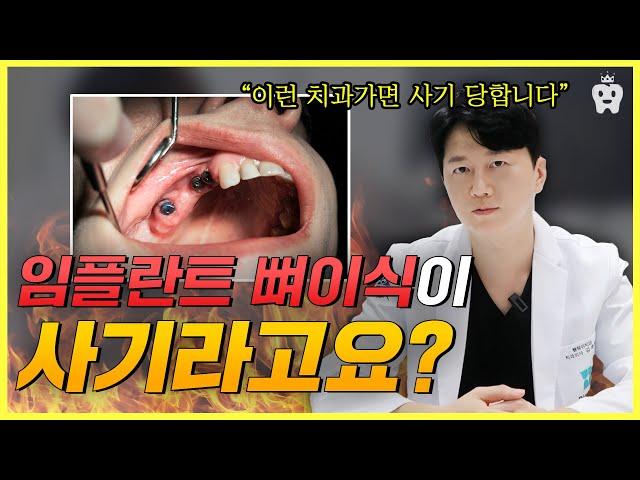 뼈이식 사기 당하기 싫으면 "이렇게 말하세요" 임플란트 치과 고르는 최고의 방법