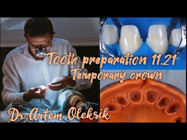 A lesson in the preparation of teeth for crowns. Temporary crowns. Dr. Artem Oleksik.