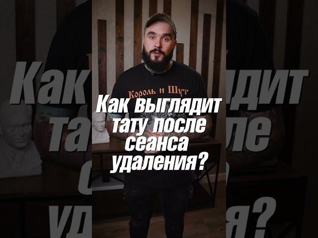 Как исчезает тату? Этапы лазерного удаления #shorts