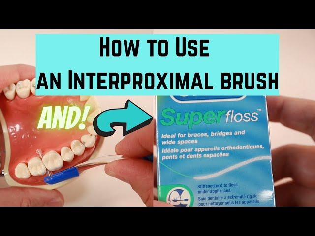 How to use an interproximal brush and superfloss.