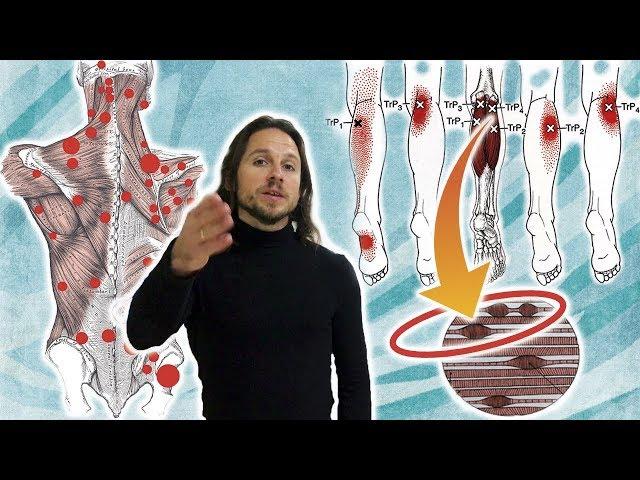 What is myofascial syndrome,  trigger points in muscles and  myofascial release ⭐ SLAVYOGA