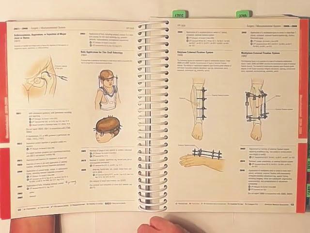 2020 CPT Musculoskeletal with examples