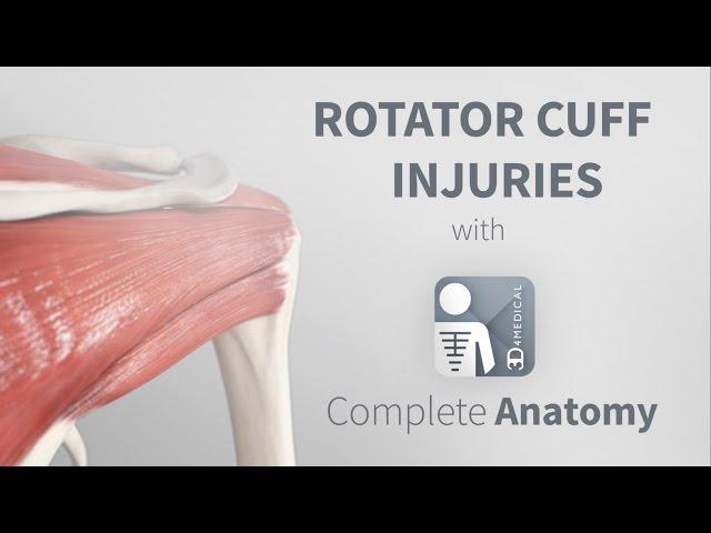 Rotator Cuff Injuries | Complete Anatomy