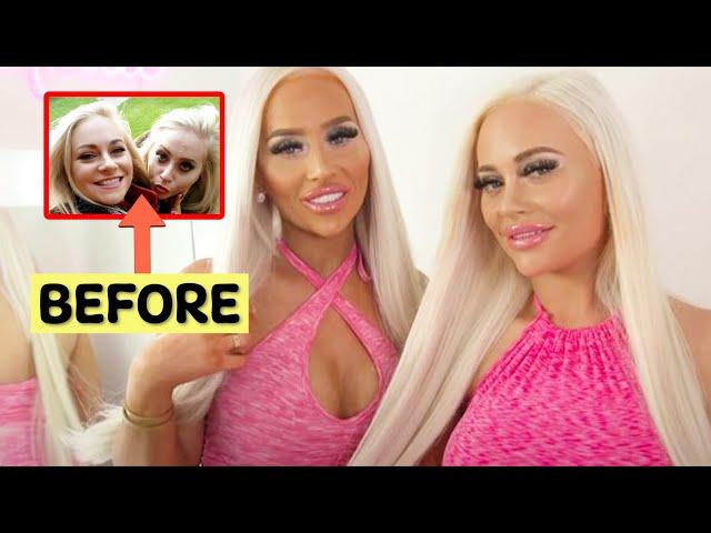 Twin sisters spend £140k to...look MORE alike? | Opt into Beauty