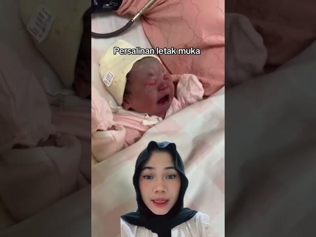 Muka bayi lahir biru