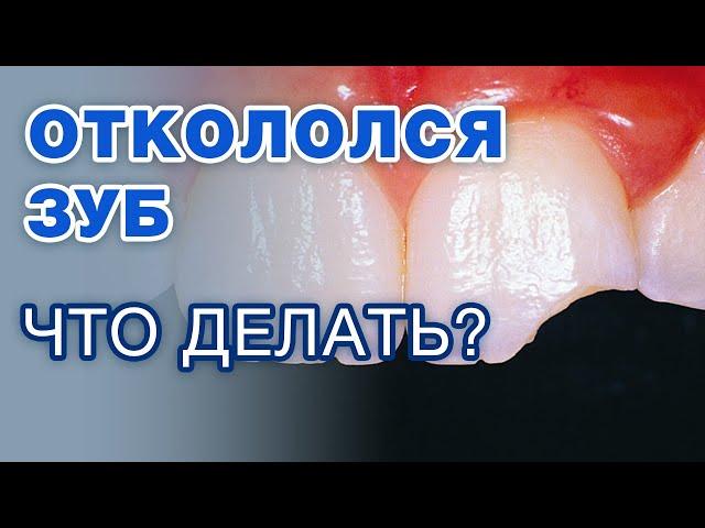 Что делать если ОТКОЛОЛСЯ кусок зуба? / Откололся зуб: как восстановить?