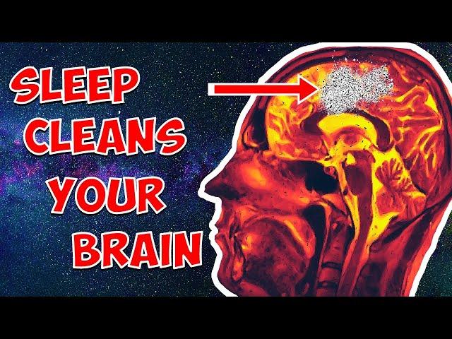 Why Your Brain MUST SLEEP  #Part2