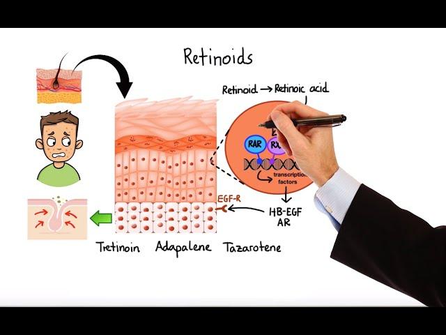 Pharmacology - ACNE TREATMENTS (MADE EASY)