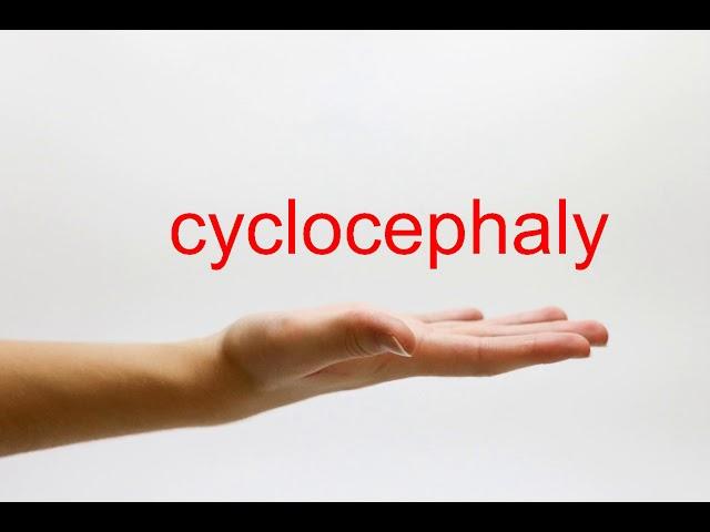 How to Pronounce cyclocephaly - American English