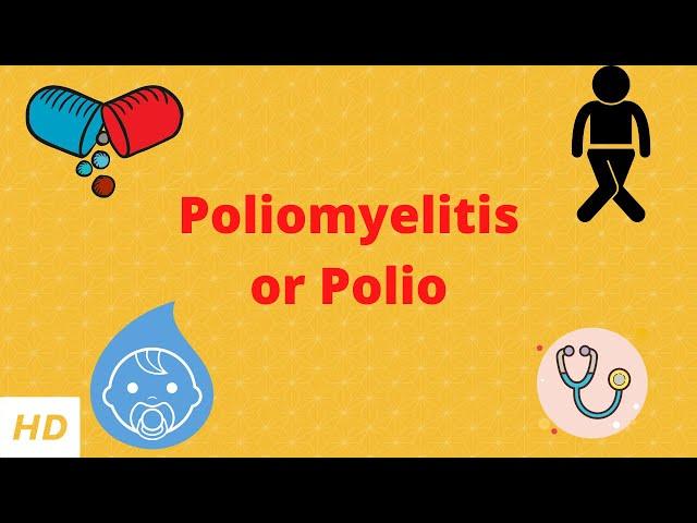 Poliomyelitis or polio, Causes, Signs and Symptoms, Diagnosis and Treatment.