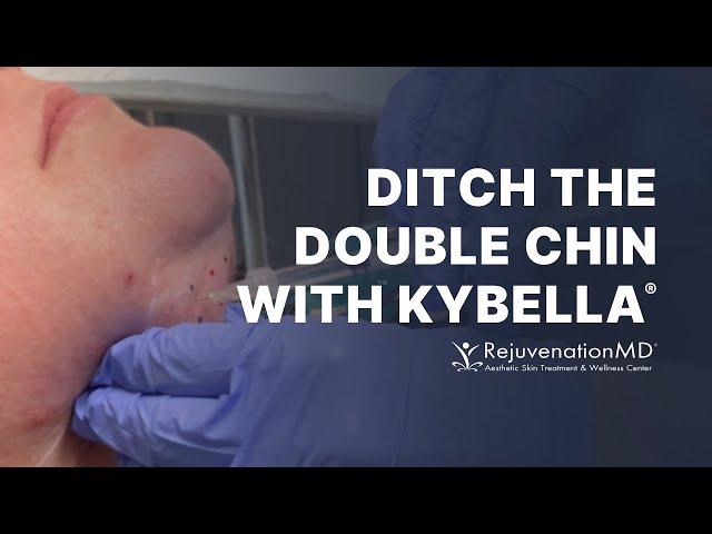 Kybella: Tailored Treatments for a Defined, Contoured Profile