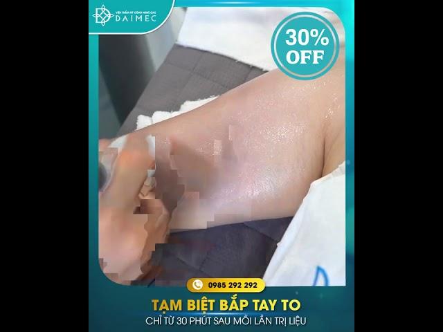 Giảm Mỡ Bắp Tay Tại Hải Phòng - Lose Arm Fat With Venus Legacy