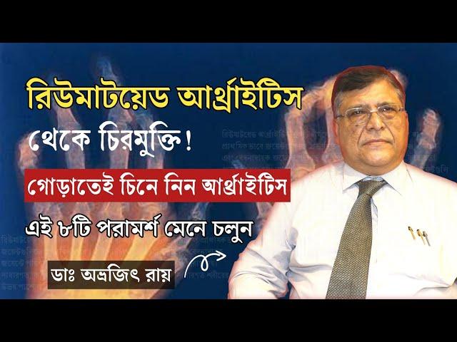 রিউমাটয়েড আর্থ্রাইটিসের লক্ষণ | রিউমাটয়েড আর্থ্রাইটিস চিকিৎসা | Rheumatoid Arthritis Treatment