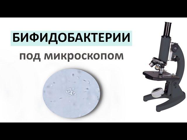 Препарат с бифидобактериями под микроскопом. Важность бифидобактерий.