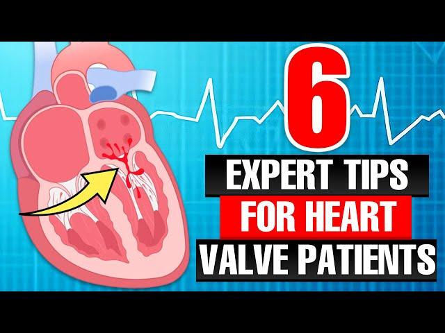Patient Webinar: 6 Expert Tips For Heart Valve Patients