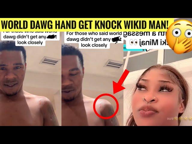 BLAMDEM Fault Nicki Minaj Get RUSH! World Dawg GVNSH0T W0UNDS REVEALED FOR THE FIRST TIME!