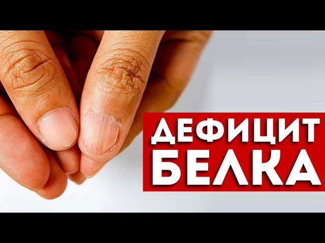 7 признаков дефицита белка, которые нельзя игнорировать