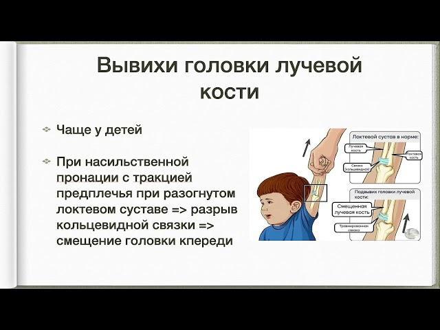 24. Переломы и переломо-вывихи предплечья. Классификация, диагностика, лечение. Вывихи предплечья.