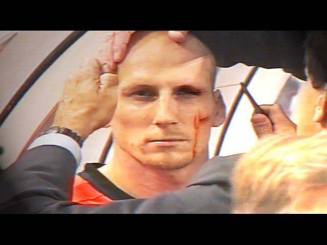 Jaap Stam eyebrow injury - EURO 2000 (Netherlands v Czech Republic)