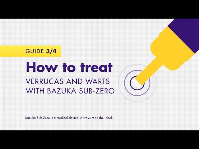 How to treat verrucas and warts with Bazuka Sub-Zero